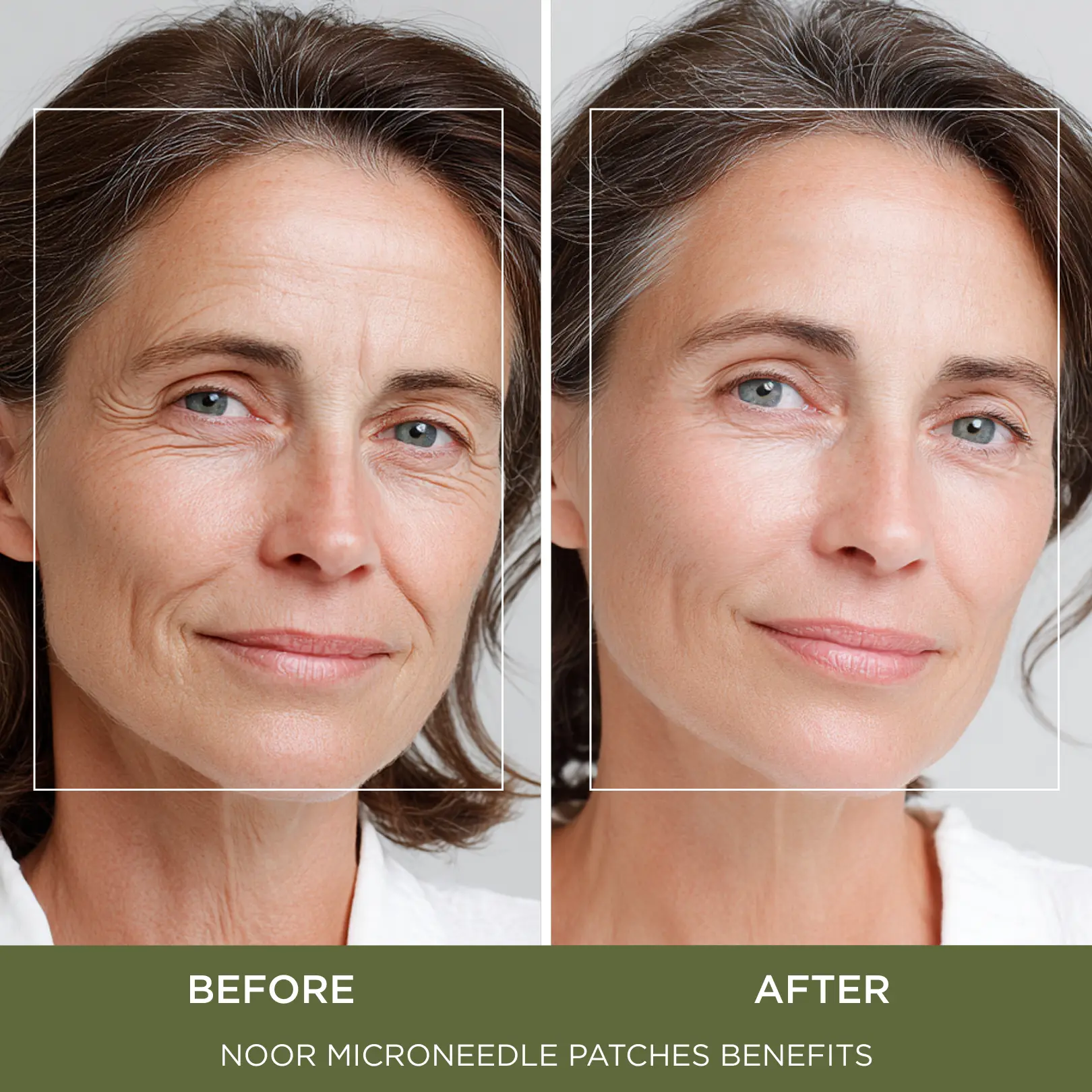 Advanced K-Beauty Microneedle Combo Mask - Image 7