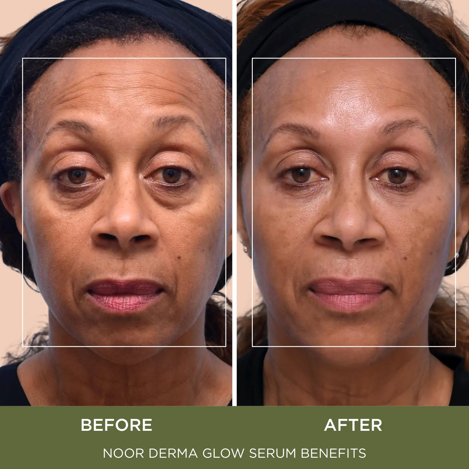 Derma Glow Serum - Image 5