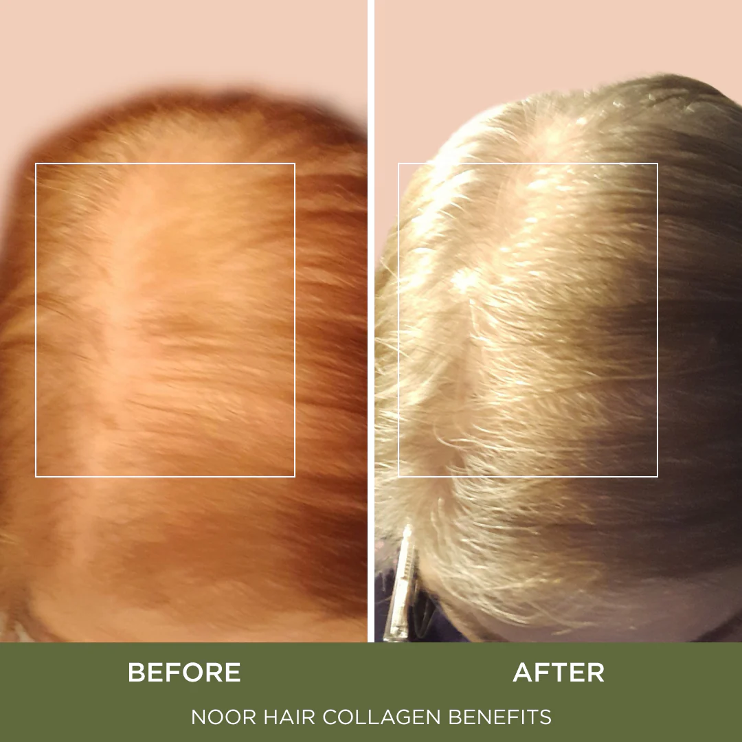 Hydrolyzed Collagen Peptides - Image 4