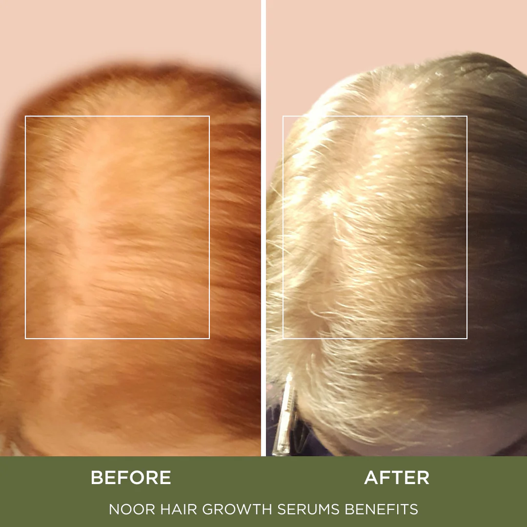 Wonder Growth Spray - Image 3